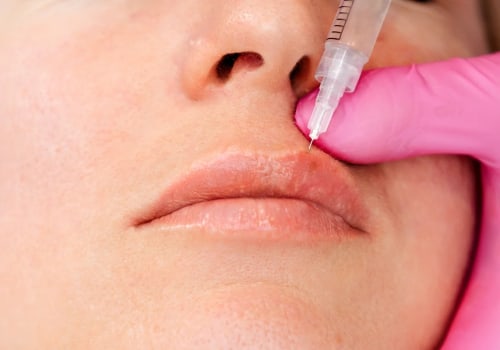 A Comprehensive Overview of Dermal Fillers